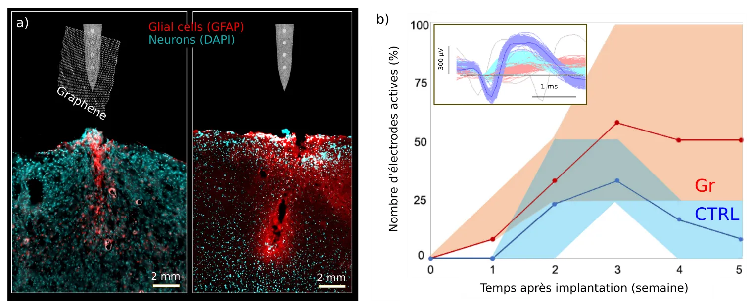 Une couverture de graphène pour réduire l'inflammation causée par les implants neuronaux