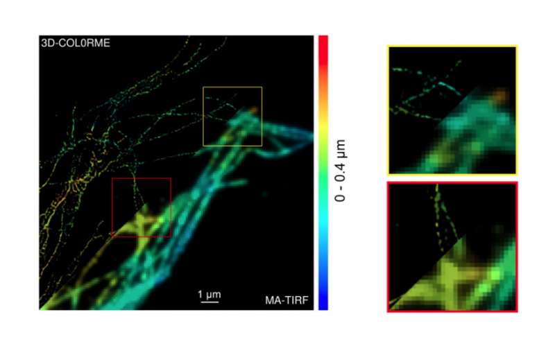 Le traitement d’images permet une résolution inégalée pour les microscopes fluorescents