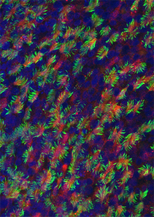 Des microARNs pour un battement de cils !