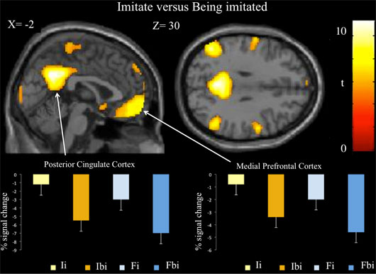 Comprendre la cognition sociale grâce à l'imagerie cérébrale