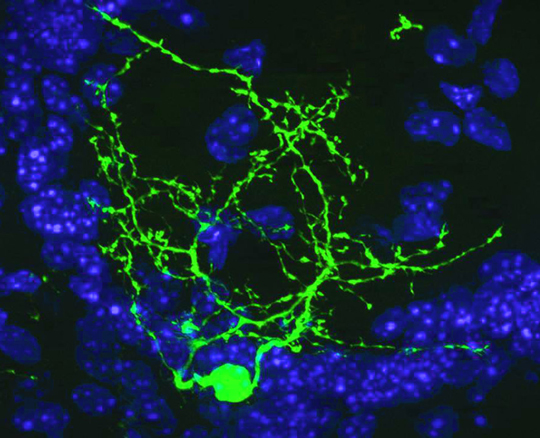Un petit ARN qui contrôle la production des neurones à dopamine