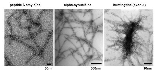 Maladies neurodégénératives et assemblages protéiques toxiques