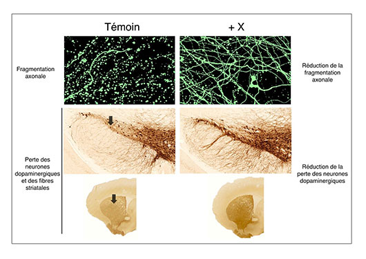 Les virus à la rescousse pour les maladies neurodégénératives ?