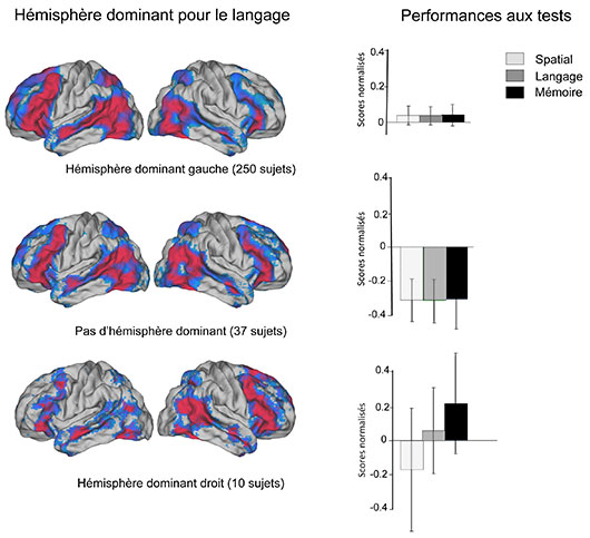 Avoir un hémisphère cérébral dominant est-il un avantage ?