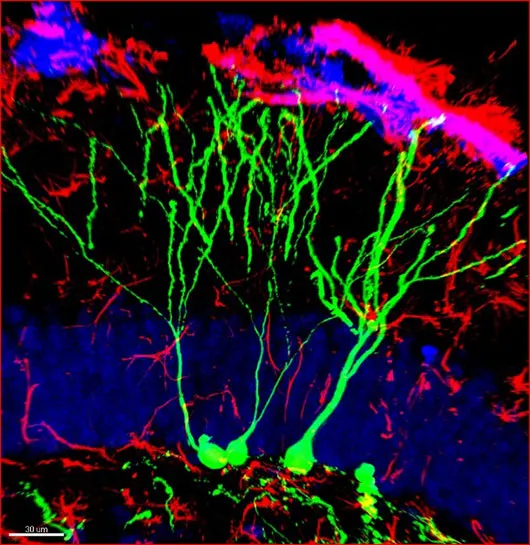 Des neurones tout neufs pour soigner le cerveau âgé