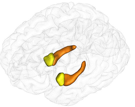 Quand la neuroimagerie permet de mesurer l'effet d'un médicament sur le cerveau