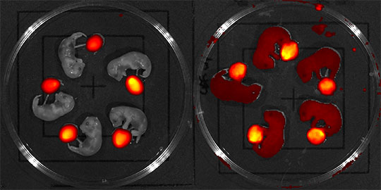 Un cheval de Troie pour rendre le foetus hémophile A tolérant au facteur VIII thérapeutique