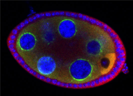 Une connexion établie entre la stabilité du génome et le syndrome de l'X fragile