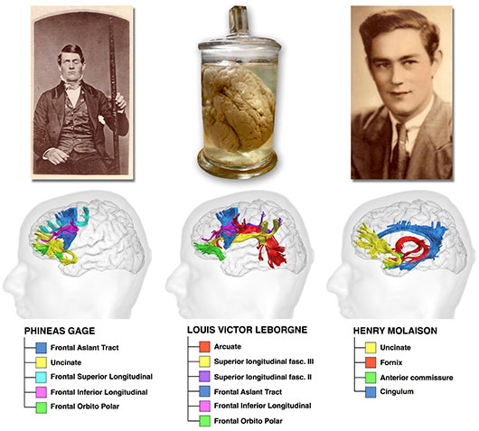 Fonctionnement du cerveau : un dogme revisité