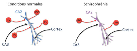 Schizophrénie: une nouvelle piste dans la compréhension des déficits de mémoire sociale