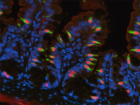 Défense contre les parasites intestinaux: cellules tuft intestinales