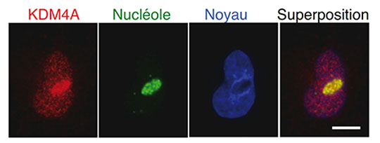 Adaptation de la cellule aux conditions environnementales : quand l'épigénétique s'en mêle
