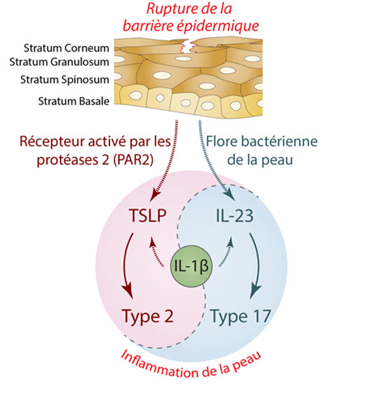 La compréhension des mécanismes inflammatoires des maladies de peau