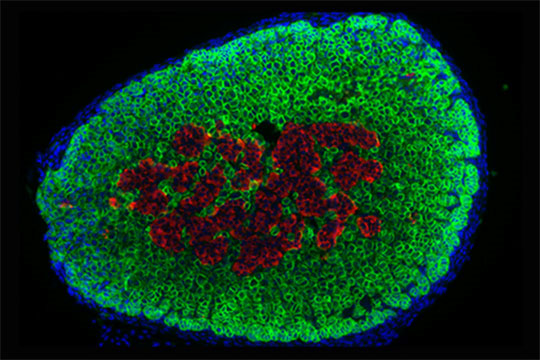 EZH2, une nouvelle cible thérapeutique dans le cancer de la surrénale