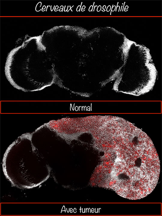 Une horloge de susceptibilité cancéreuse dans les cellules souches neurales