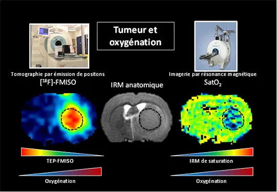 Validation d'une méthode originale d'imagerie de l'oxygénation cérébrale par IRM