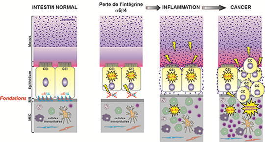 Une avancée majeure dans la compréhension des maladies inflammatoires chroniques de l'intestin et du cancer color