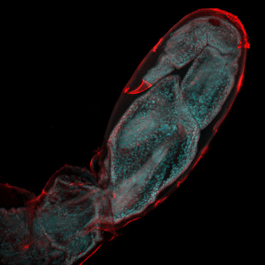 La régénération d'un membre amputé suivie cellule par cellule