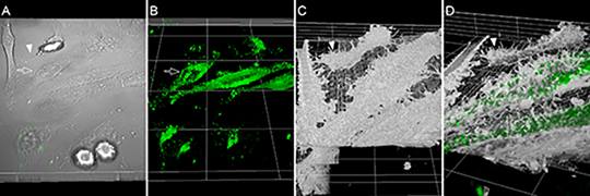 De nouveaux outils de fusion des images en microscopie corrélative