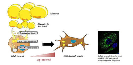 Cancers du sein: les cellules graisseuses nourrissent les cancéreuses
