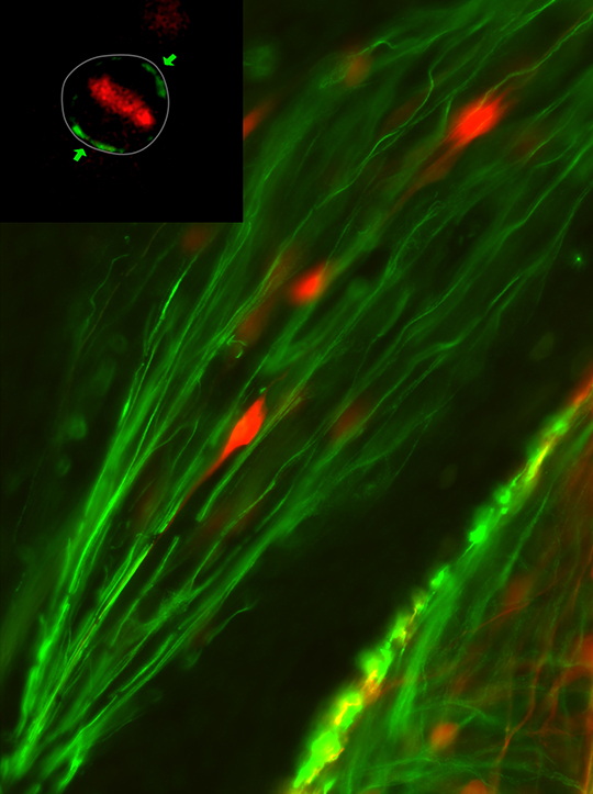 De mère en filles, les cellules neuronales se souviennent de leurs anciennes formes