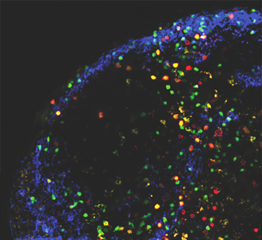 Lymphocytes T: des sentinelles en première ligne