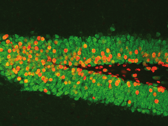 Quand les virus aident à mieux comprendre le fonctionnement du cerveau