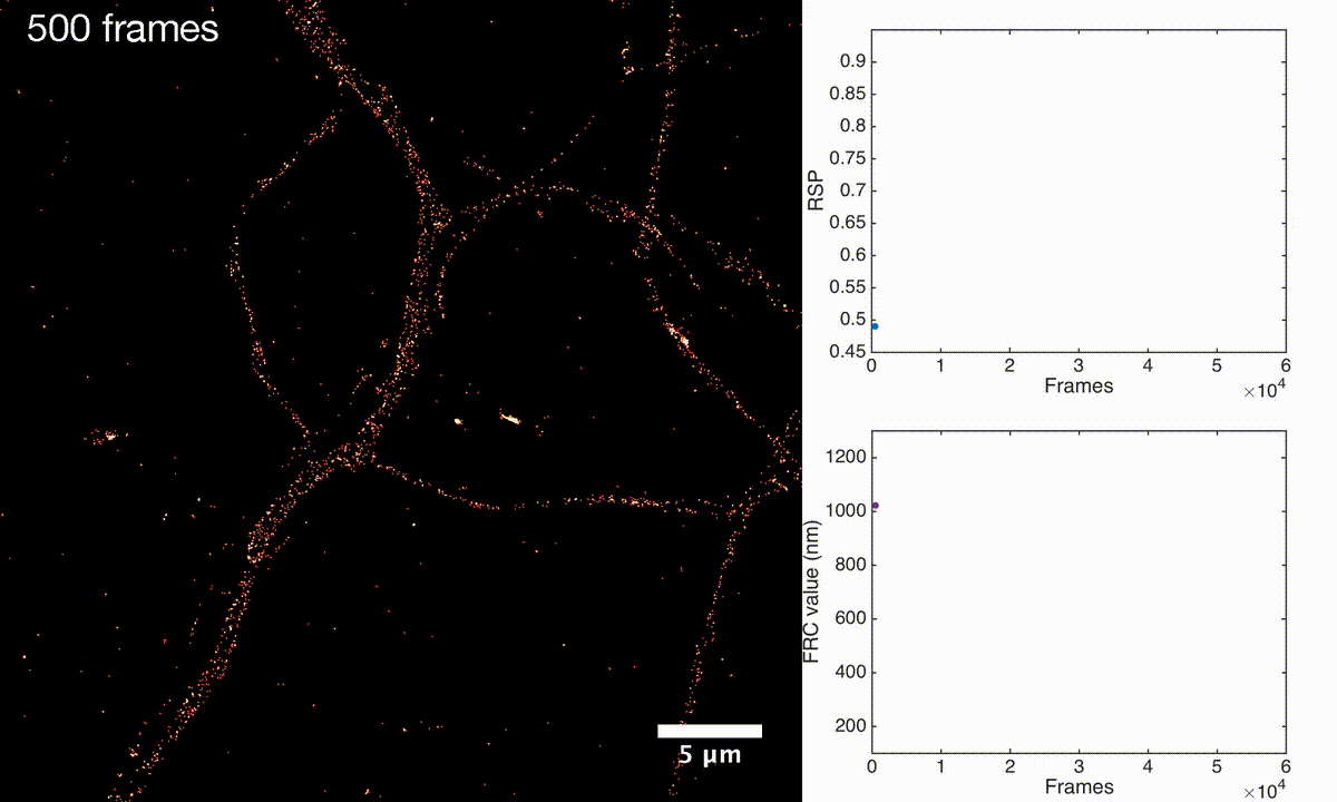 Microscopie: SQUIRREL pour en finir avec les images à la noix !