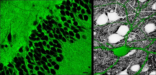 Sortir de l'ombre: les espaces extracellulaires du cerveau dévoilés