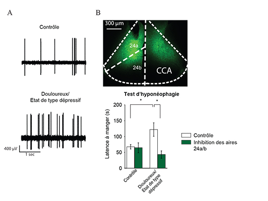 Le cortex cingulaire antérieur, entre douleur et dépression