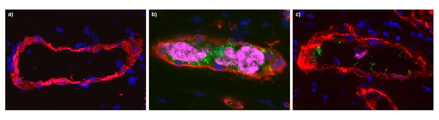 Les pili de type IV comme cibles d'une nouvelle stratégie thérapeutique contre le méningocoque