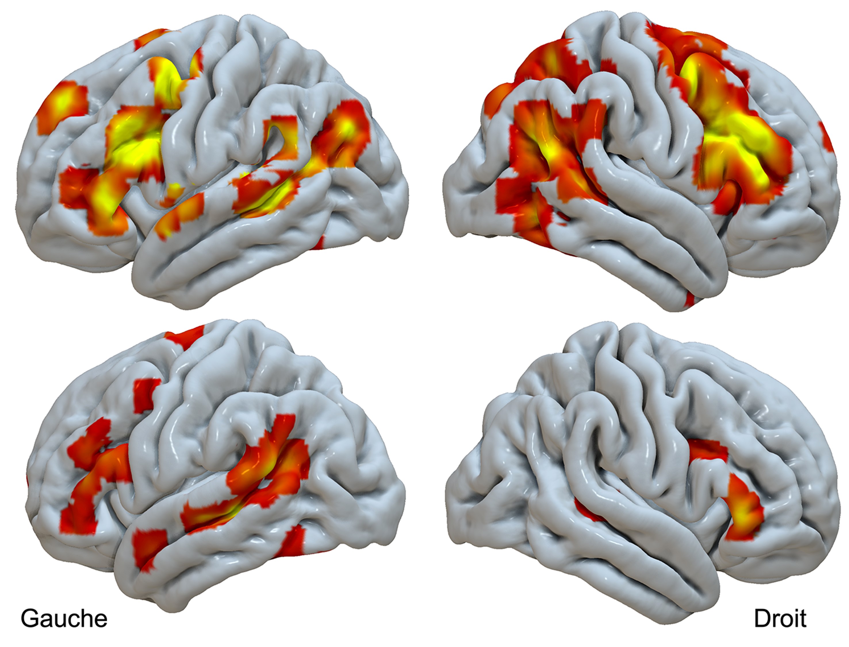 La latéralisation du cerveau provient-elle de gènes régulant le squelette des cellules ?