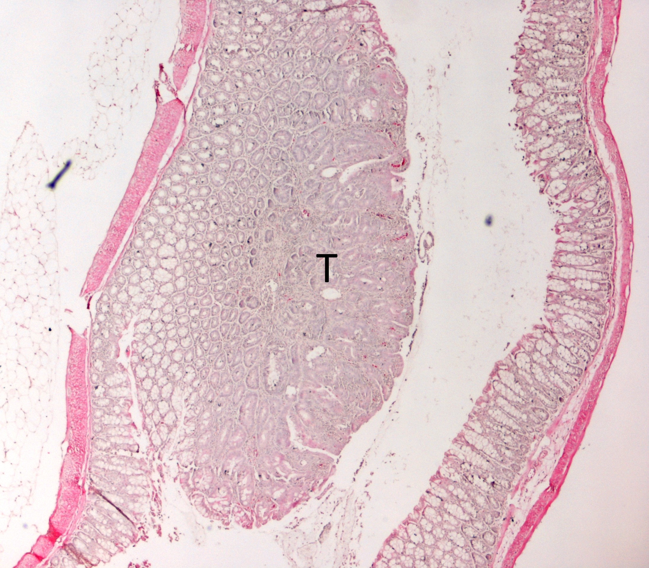La protéine ASB2α, un acteur-clef de la réponse immunitaire dans le cancer colorectal
