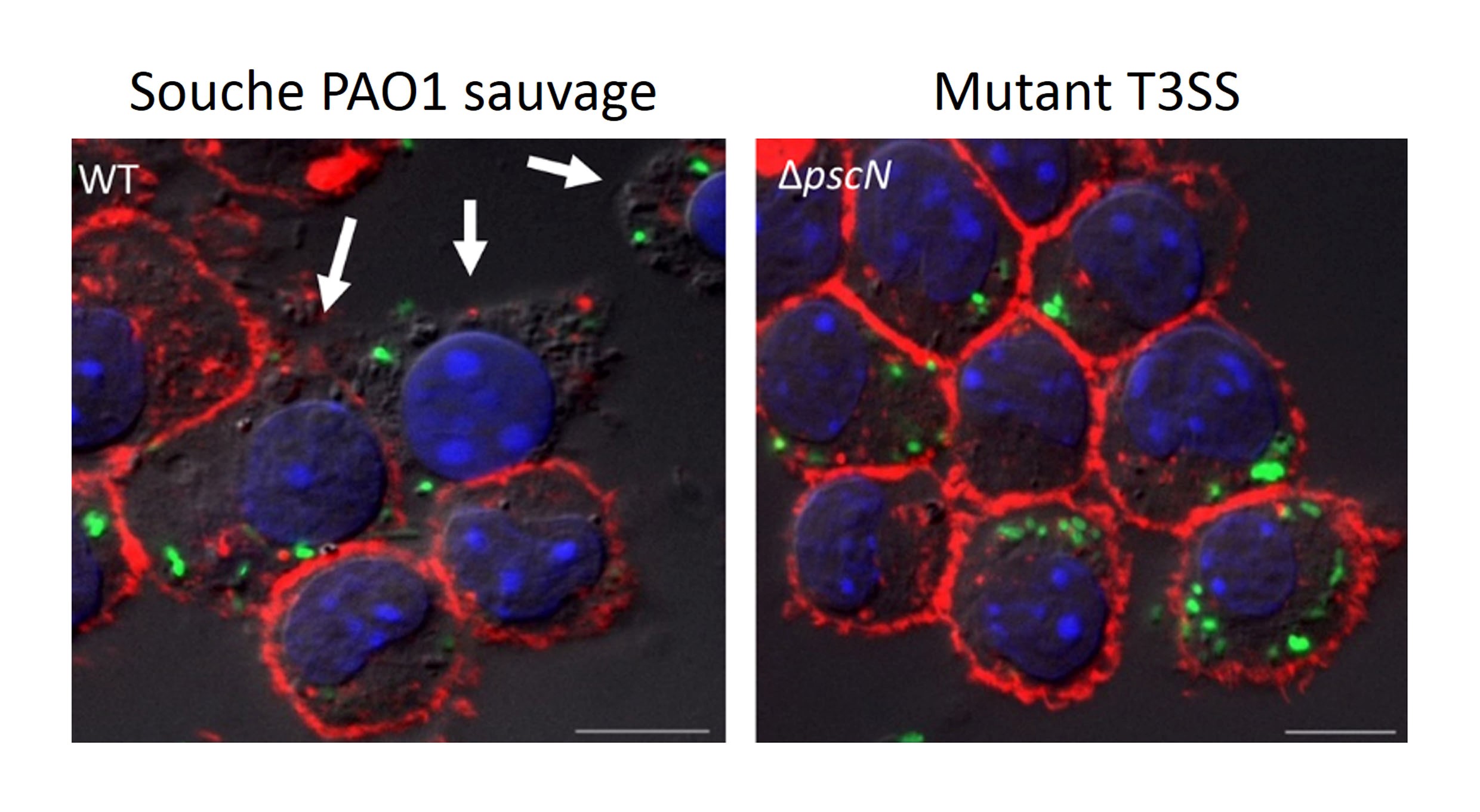 Tuer avant d’être tué: comment une bactérie pathogène résiste au macrophage