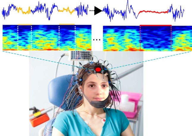 L’Intelligence Artificielle pour éviter une anesthésie trop profonde