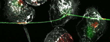 SIGLEC-1: un récepteur qui favorise la dissémination du virus dans la co-infection VIH/tuberculose
