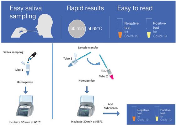 COVID-19: des premiers résultats prometteurs pour un test de diagnostic salivaire