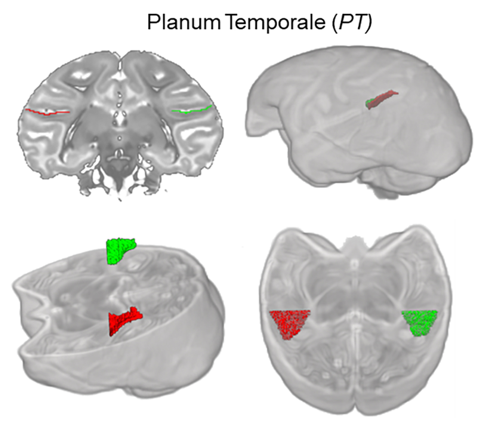 Un cerveau déjà prêt pour le langage chez les bébés singes ?