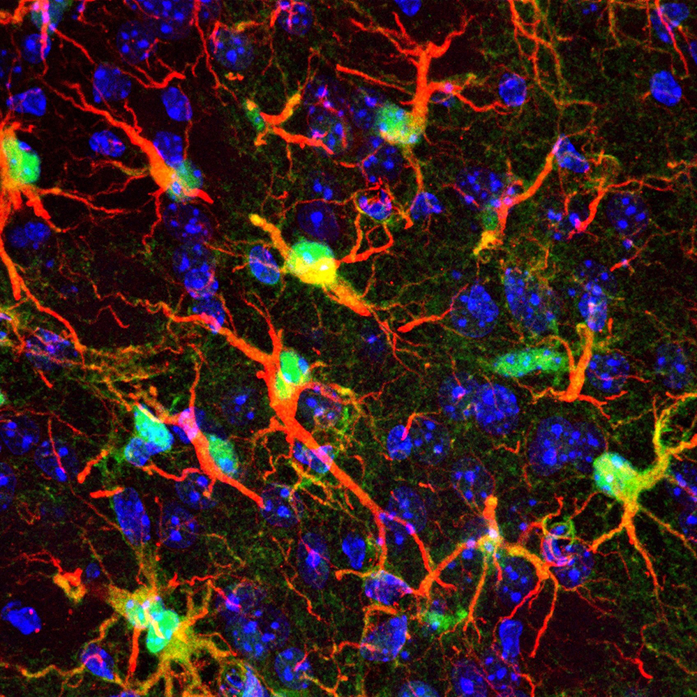 Consensus sur les astrocytes, partenaires négligés des neurones dans les maladies cérébrales