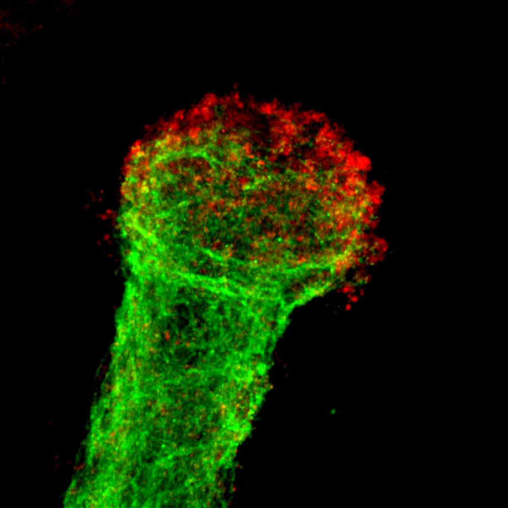 Comment les vieux axones attirent les cellules gliales pour être mangés