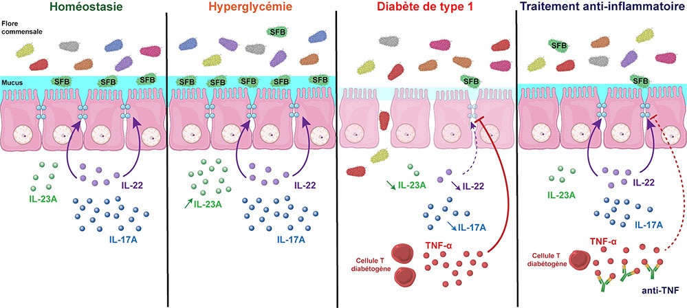 les altérations intestinales associées au diabète type 1 sont associées à l’inflammation de la muqueuse
