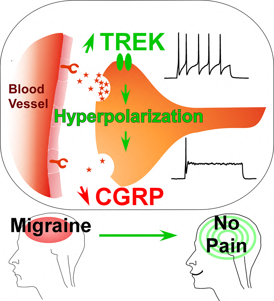 Vers un traitement efficace de la migraine
