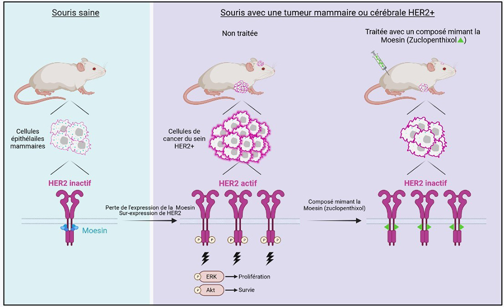 De nouvelles molécules pour traiter cancers du sein et métastases cérébrales