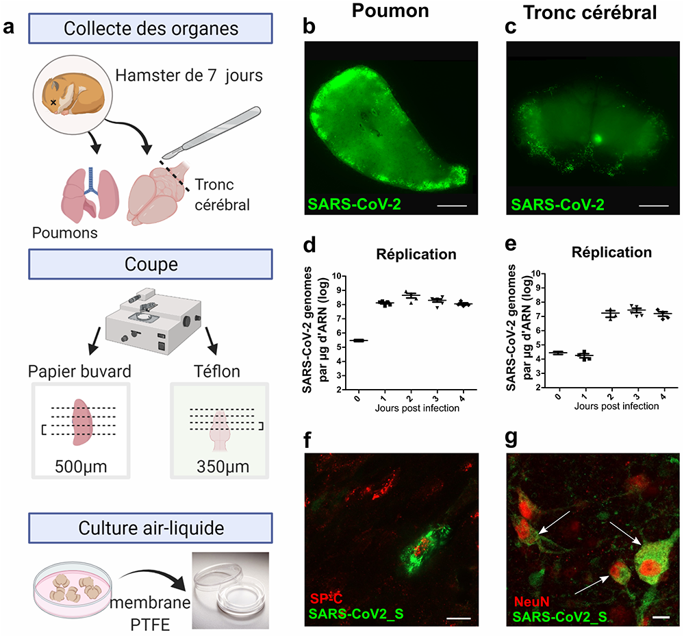 COVID-19: modéliser rapidement l’infection par SARS-CoV-2