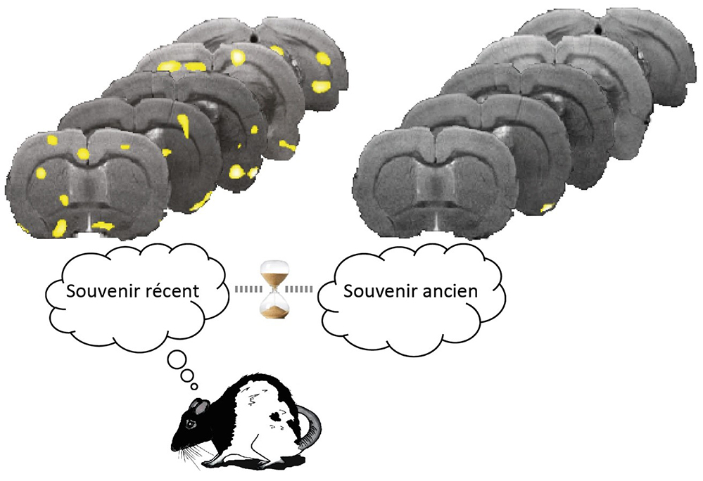 Comment le cerveau fait persister les mémoire de peur