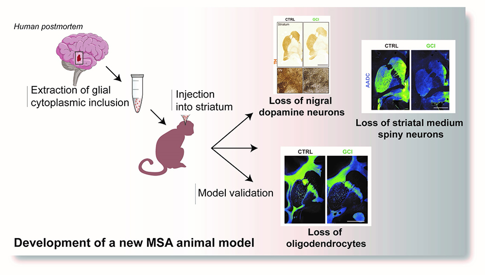 Atrophie: un nouveau modèle animal reproduit plus fidèlement la maladie humaine