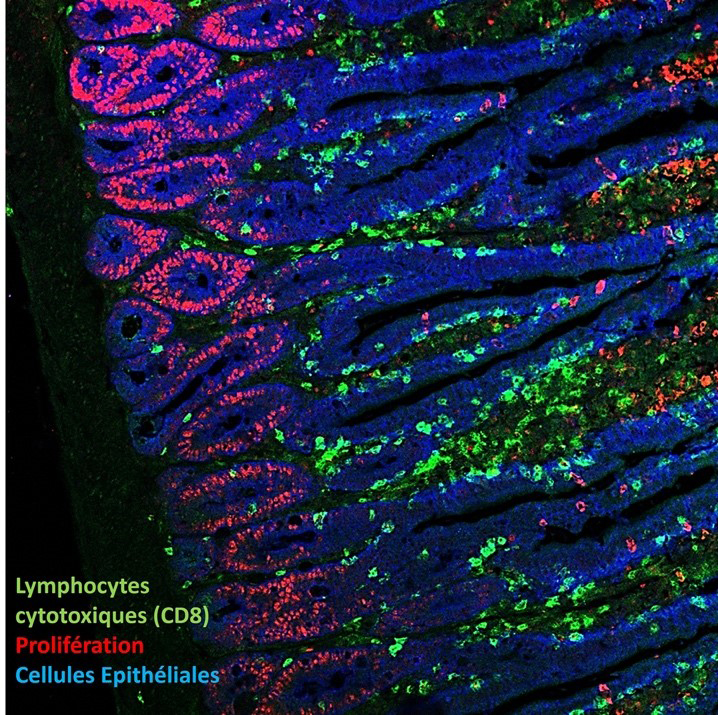 Comment nos lymphocytes dérapent et s’attaquent à notre flore intestinale ?