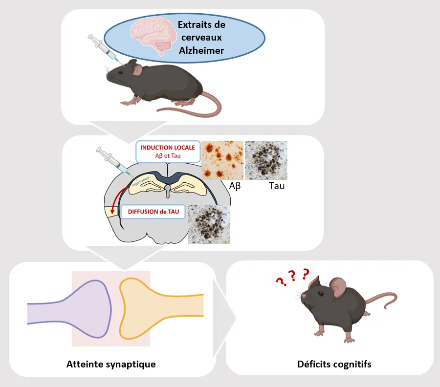 Transmettre la pathologie Alzheimer pour comprendre l'origine des atteintes cognitives