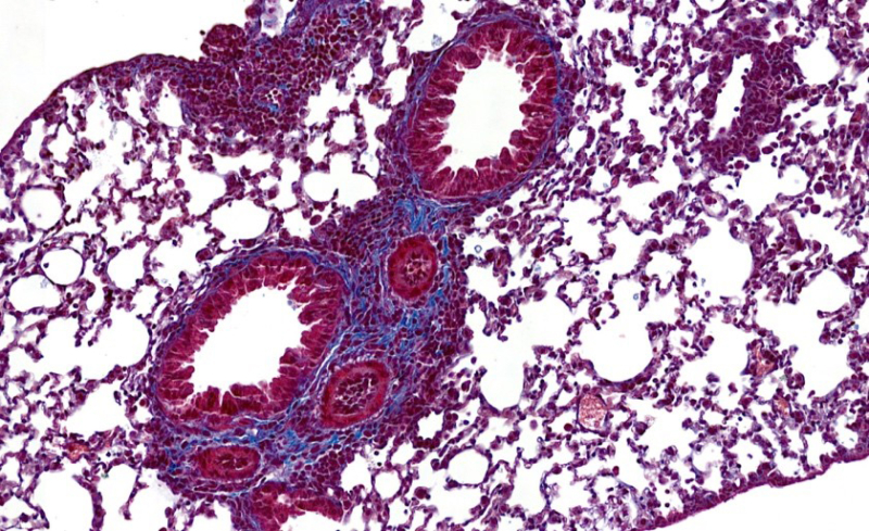 Une nouvelle cible thérapeutique contre l’asthme 🫁