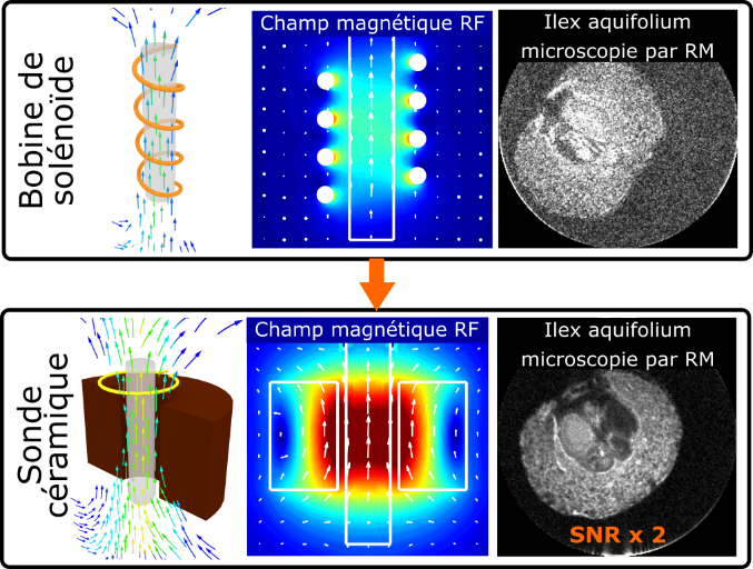 Une antenne en céramique améliore la qualité des images par résonance magnétique